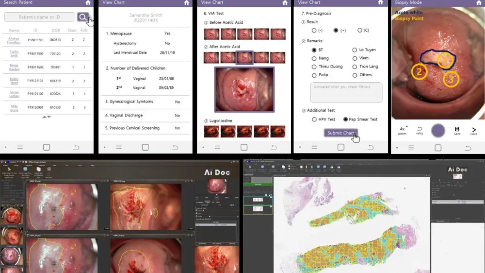 AI Doc : AI Diagnosis and Prediction Platform for Female Cancer